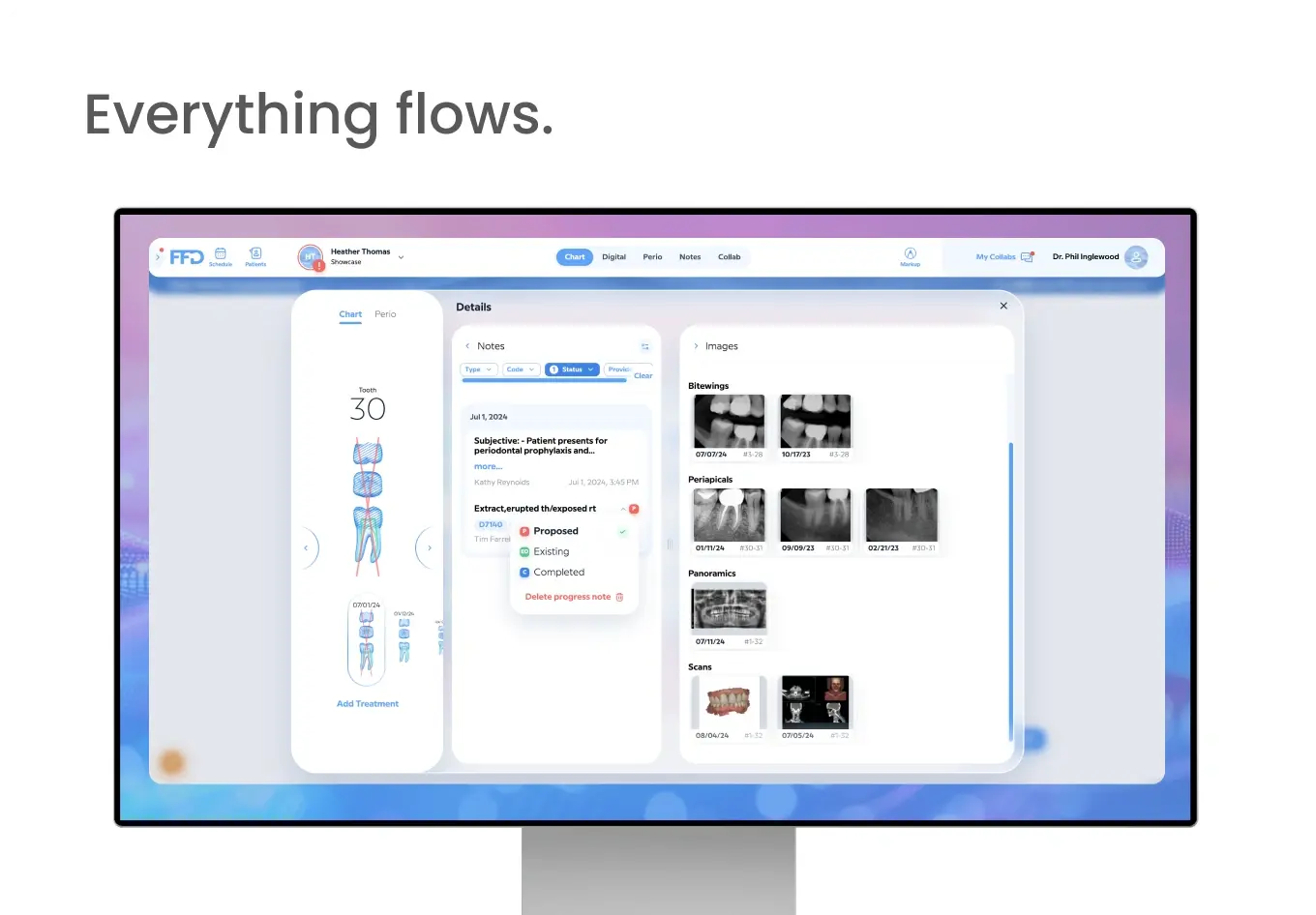 Chart-everythingflows