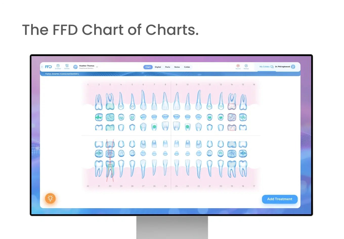 Chat-ThechartofCharts