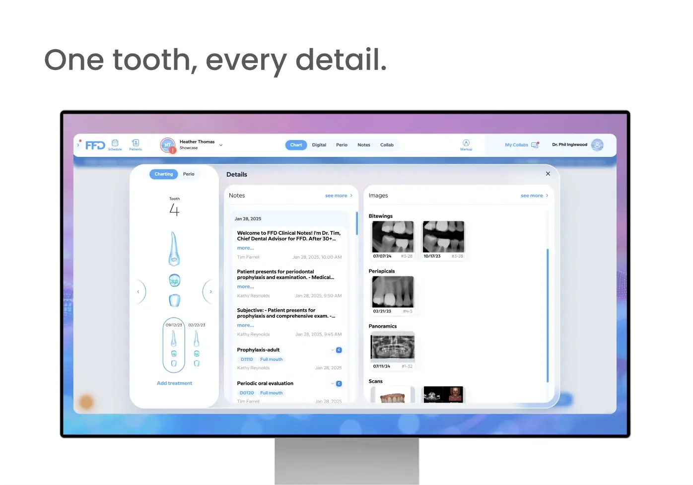 One tooth, every detail.