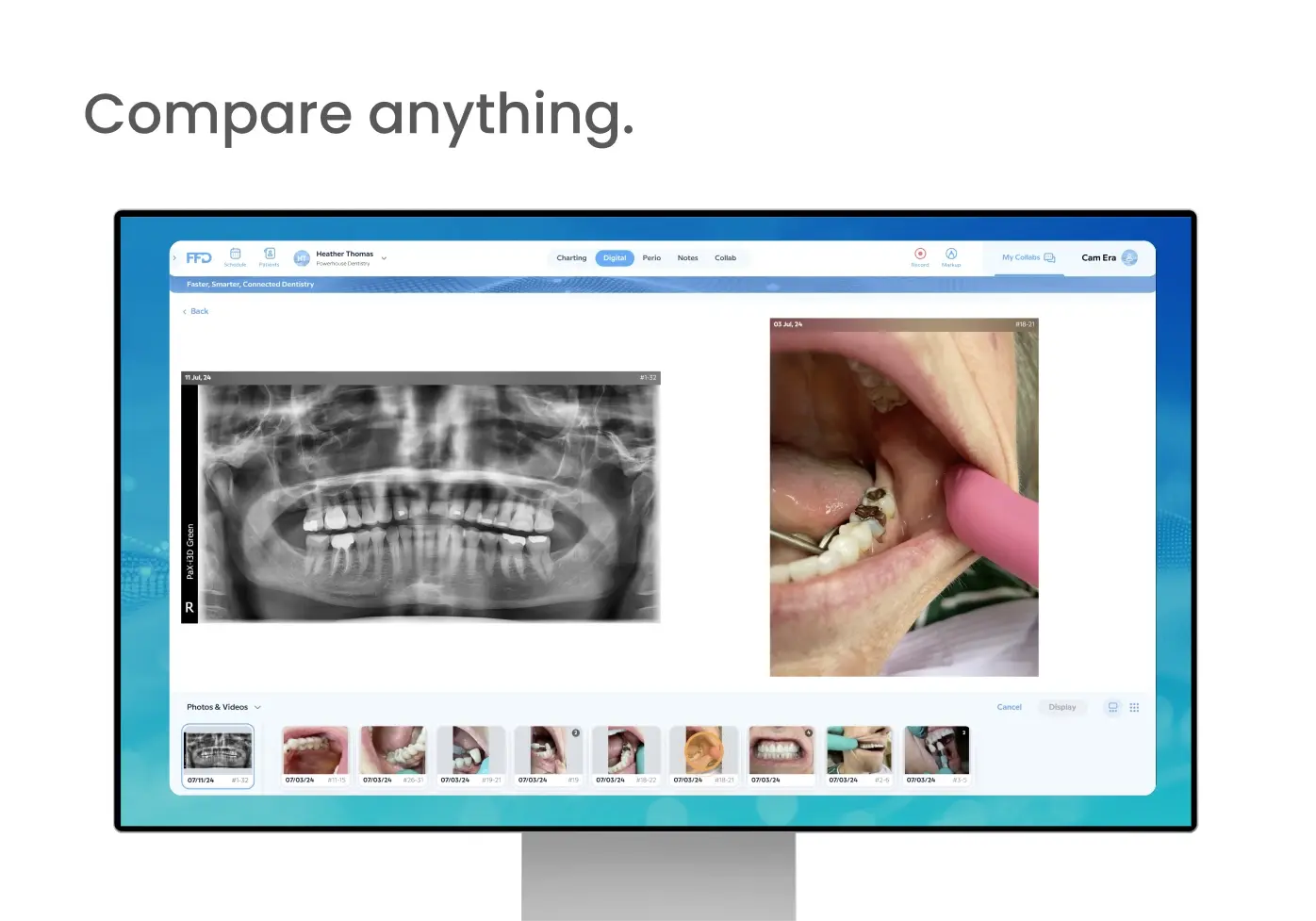Compare anything.